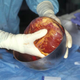 Illustration for article titled Insurance Only Covers Generic Heart Transplant